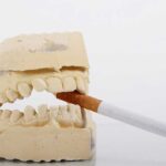 Why does cigarettes make teeth yellow?