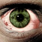 Natural treatments for conjunctivitis